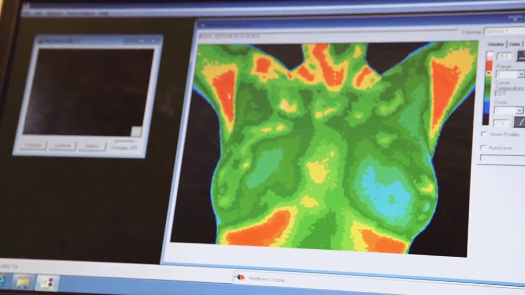 Thermography results for Thermal Breast Imaging at Narberth Family Medicine & Acupuncture Center